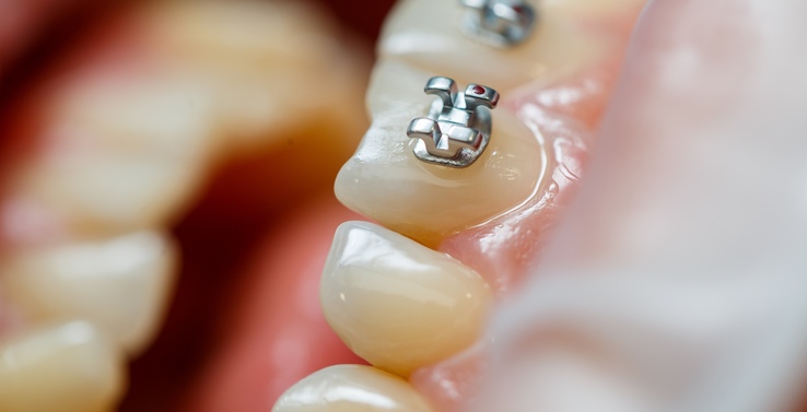 À Rouen, l'impudence d'une orthodontiste mise en cause pour une fraude majeure à la sécurité sociale