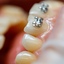 À Rouen, l'impudence d'une orthodontiste mise en cause pour une fraude majeure à la sécurité sociale